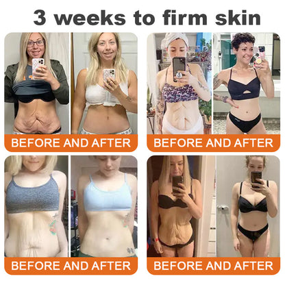 ✨Made and Shipped from USA ✨ ODALIT™ Bee venom Comprehensive Cream 🔥 LAST DAY 80% OFF 💎💎