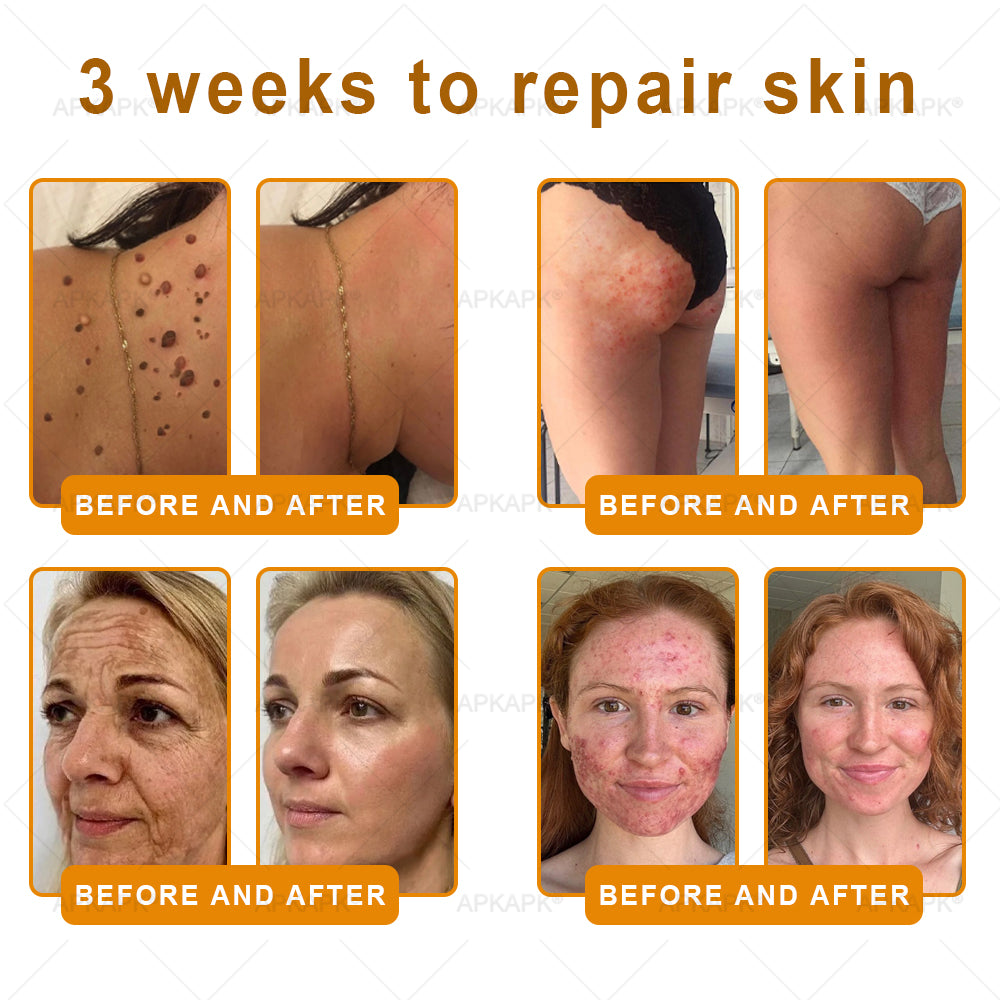 ODALIT™ | Eliminates wrinkles and firms sagging skin in 7 days.