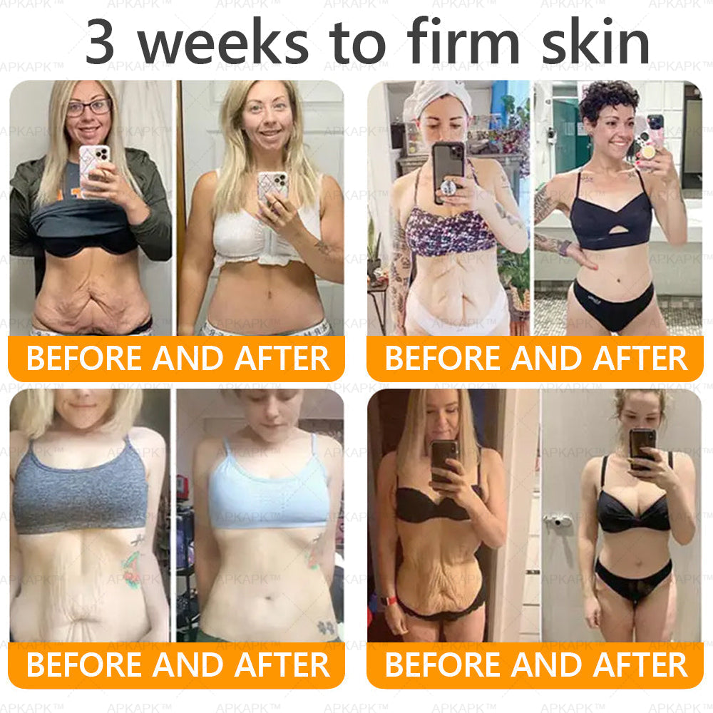 ODALIT™ | Eliminates wrinkles and firms sagging skin in 7 days.