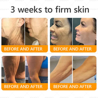 ODALIT™ | Eliminates wrinkles and firms sagging skin in 7 days.