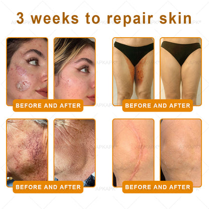 ODALIT™ | Eliminates wrinkles and firms sagging skin in 7 days.