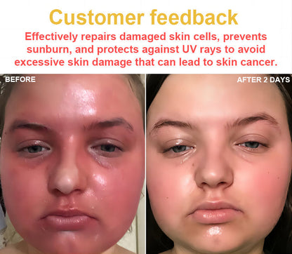 NESLEMY™ Bee Venom Skin Cream（👨‍⚕AAD Recommended),for Remove Warts, Acne and Scars