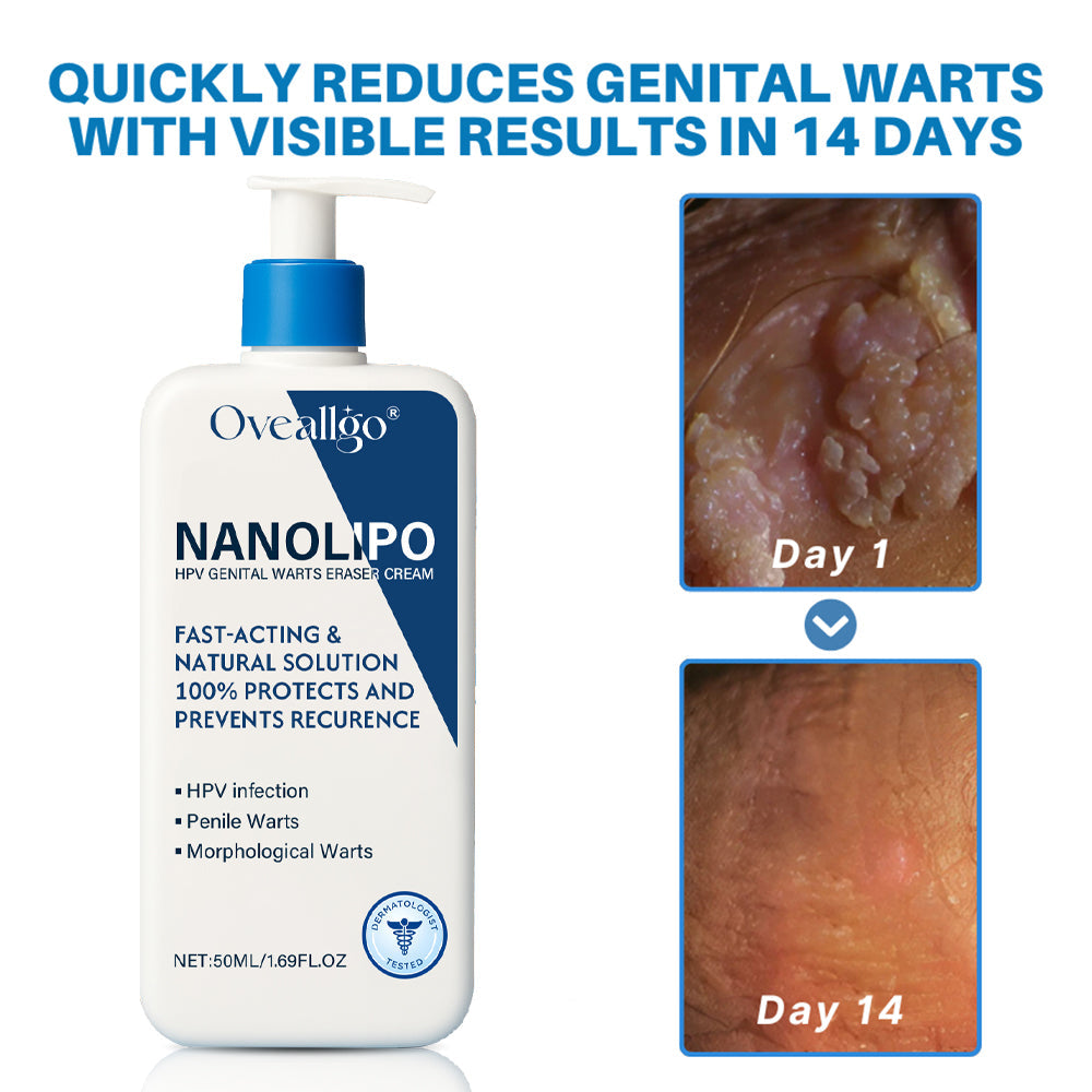 Oveallgo® NanoLipo HPV Genital Warts Eraser Cream PRO