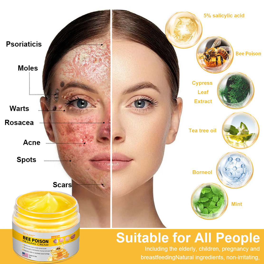 NESLEMY™ Bee Venom Skin Cream（👨‍⚕AAD Recommended),for Remove Warts, Acne and Scars