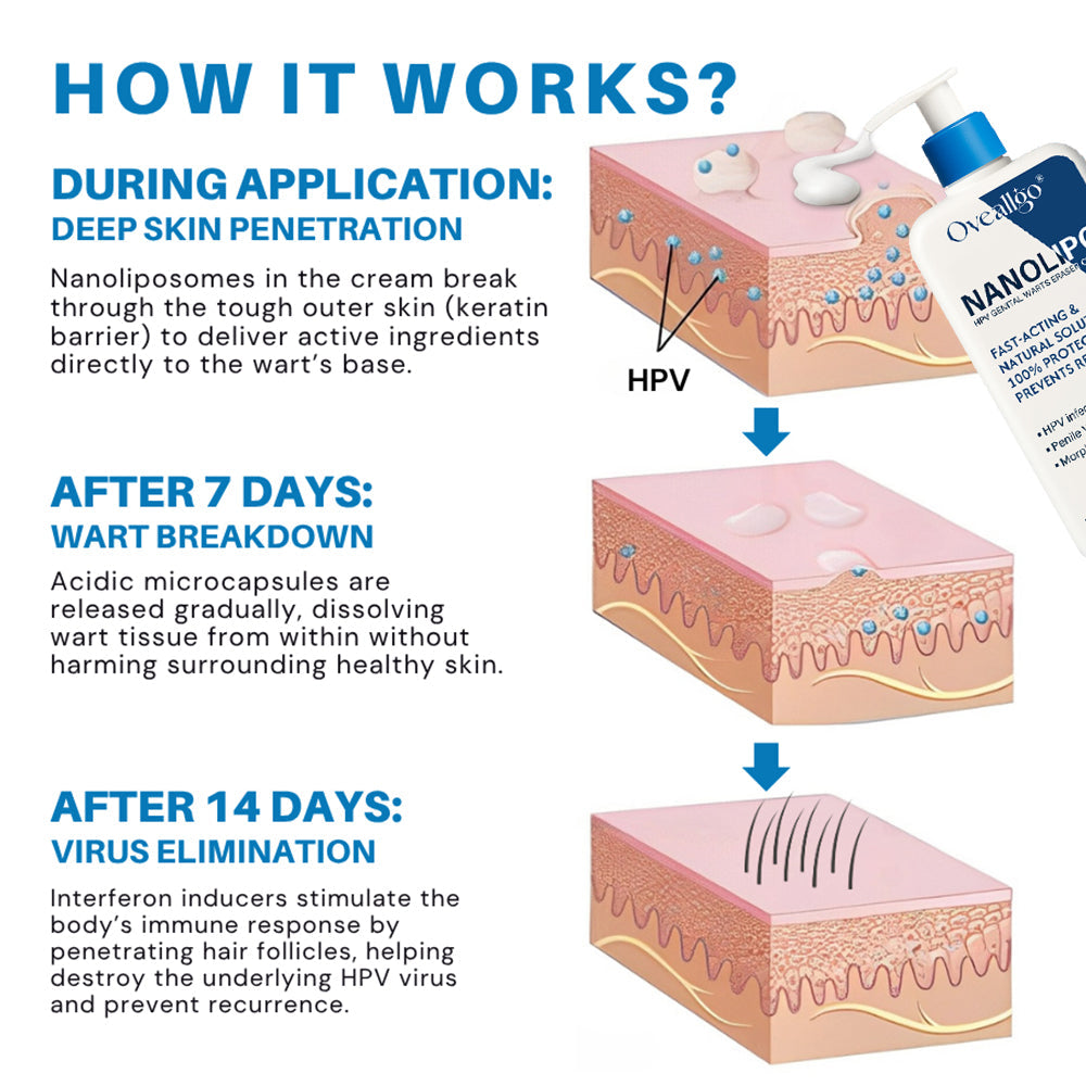 Oveallgo® NanoLipo HPV Genital Warts Eraser Cream PRO