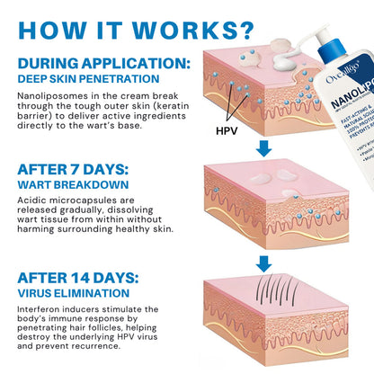 Oveallgo® NanoLipo HPV Genital Warts Eraser Cream PRO