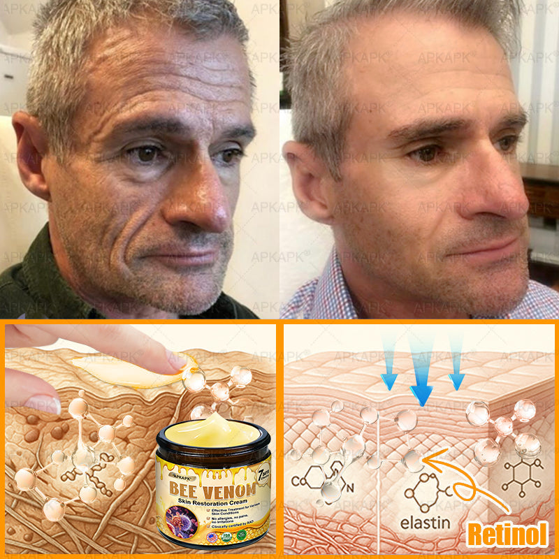ODALIT™ | Eliminates wrinkles and firms sagging skin in 7 days.