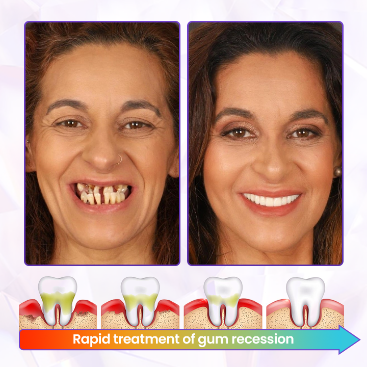 BeeRenew Advanced Gum Healing Toothpaste