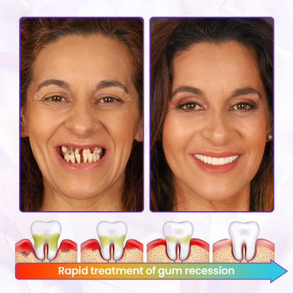 BeeRenew Advanced Gum Healing Toothpaste
