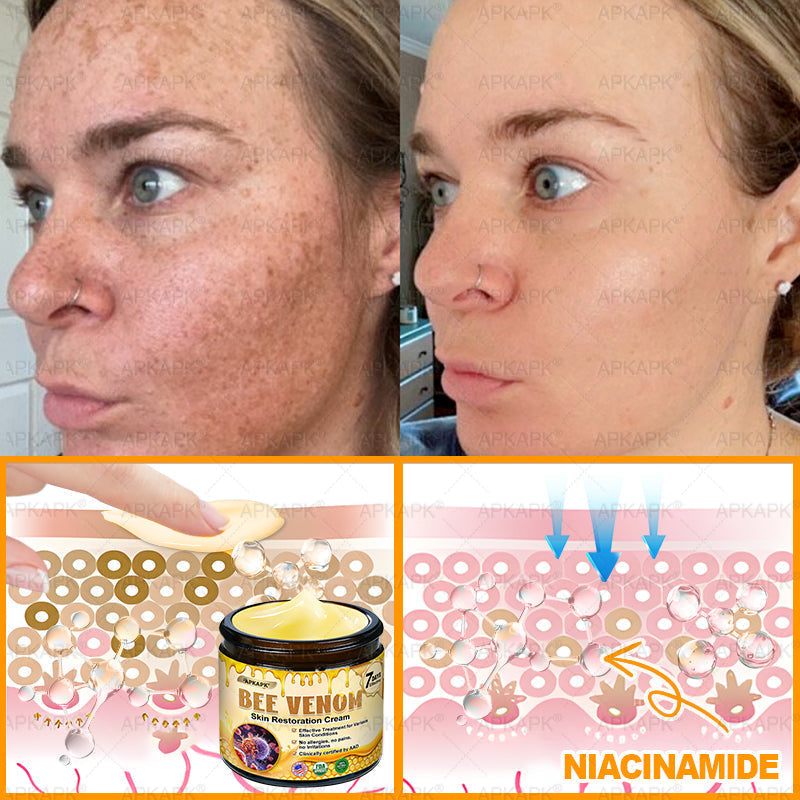 ODALIT™ | Eliminates wrinkles and firms sagging skin in 7 days.