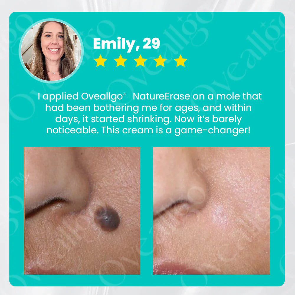 ✅ Official Store: Oveallgo® NatureErase Instant Alligator Oil Mole & Spot Removal Plus Gel