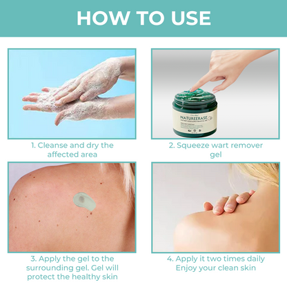 ✅ Official Store: Oveallgo® NatureErase Instant Alligator Oil Mole & Spot Removal Plus Gel