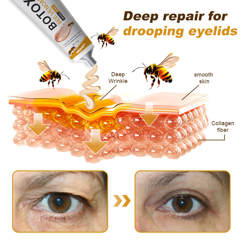 (Made and Shipped from USA) 🧑‍⚕️NEGUSY® Botox Bee Venom Wrinkle Removal Cream