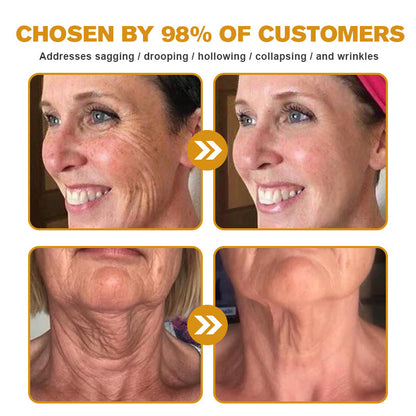 (Made and Shipped from USA) 🧑‍⚕️NEGUSY® Botox Bee Venom Wrinkle Removal Cream